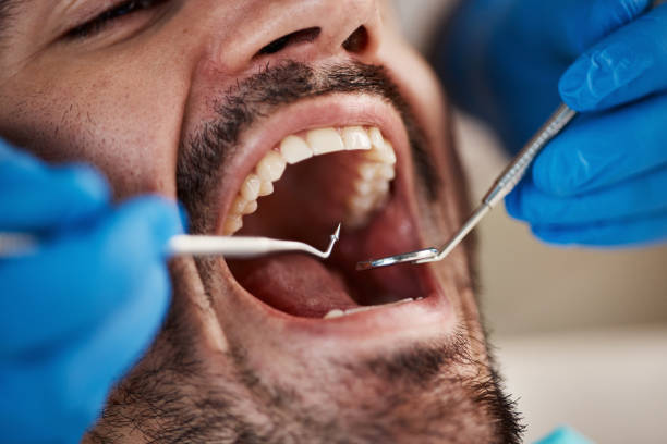 Best Emergency Gum Treatment in Fair Oaks, VA